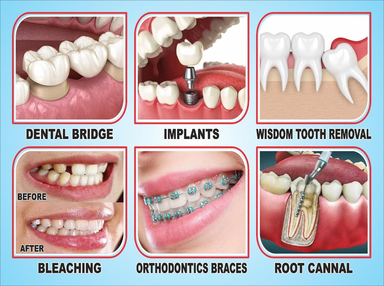 Dental treatment guide including bridge, implants, wisdom tooth removal, bleaching, orthodontic braces and root canal treatment